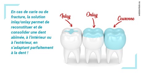 https://selarl-grangeon-bissuel-et-associes.chirurgiens-dentistes.fr/L'INLAY ou l'ONLAY