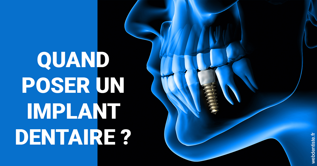 https://selarl-grangeon-bissuel-et-associes.chirurgiens-dentistes.fr/Les implants 1