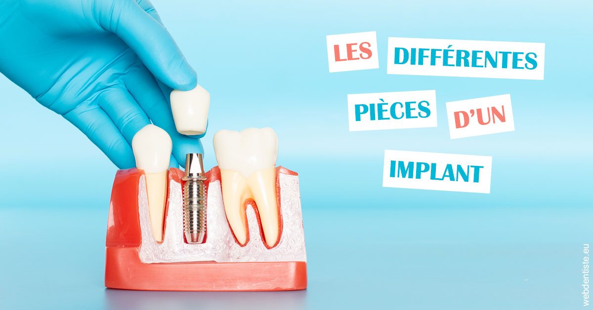 https://selarl-grangeon-bissuel-et-associes.chirurgiens-dentistes.fr/Les différentes pièces d’un implant 2