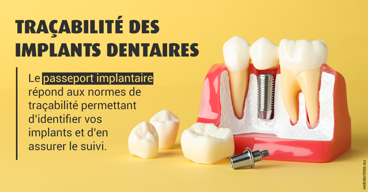 https://selarl-grangeon-bissuel-et-associes.chirurgiens-dentistes.fr/T2 2023 - Traçabilité des implants 2