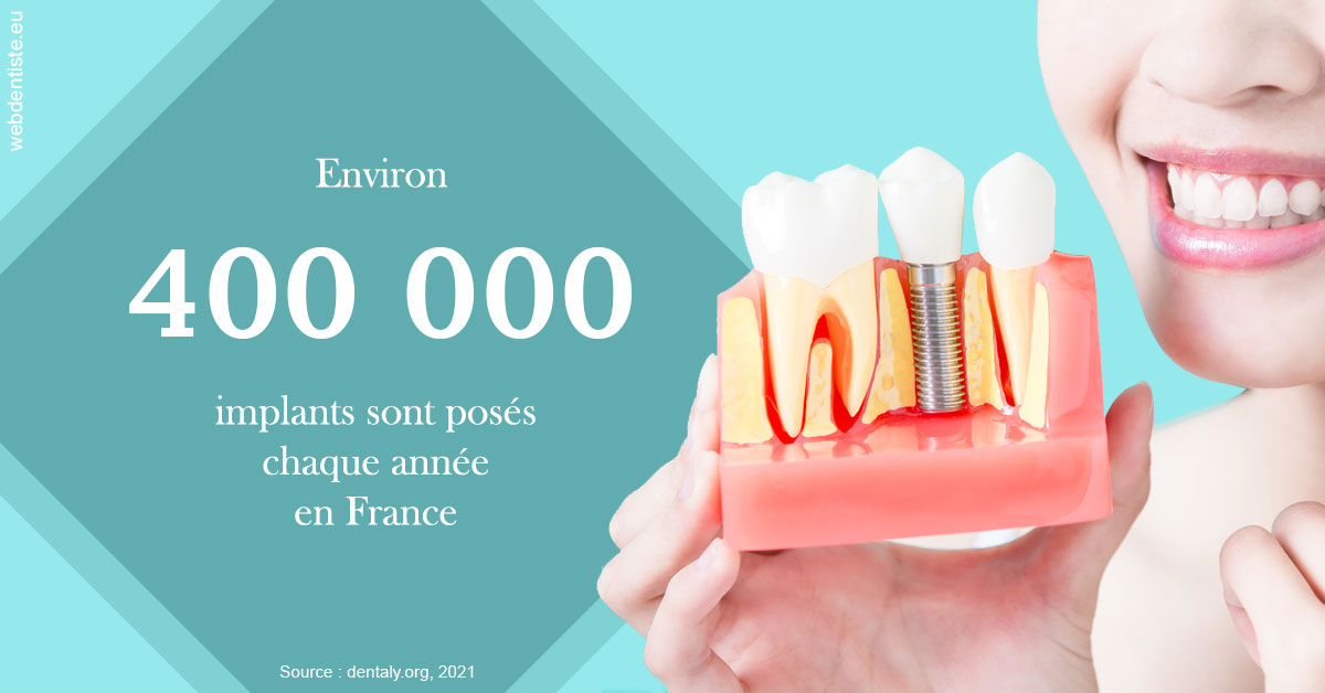 https://selarl-grangeon-bissuel-et-associes.chirurgiens-dentistes.fr/Pose d'implants en France 2
