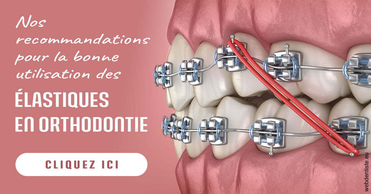 https://selarl-grangeon-bissuel-et-associes.chirurgiens-dentistes.fr/Elastiques orthodontie 2